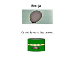 Bexiga
Os dois furos na lata de oleo
 