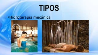TIPOS
•Hidroterapia mecánica
 