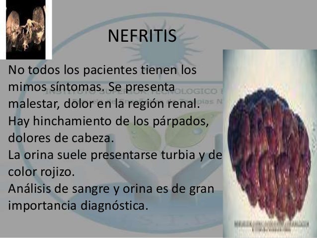 El tratamiento de la hernia del departamento lumbar sin operación