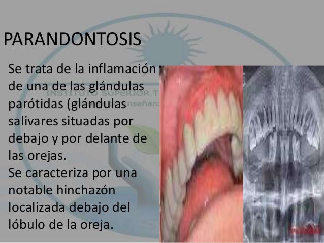 Las medicinas contra los parásitos ukraina