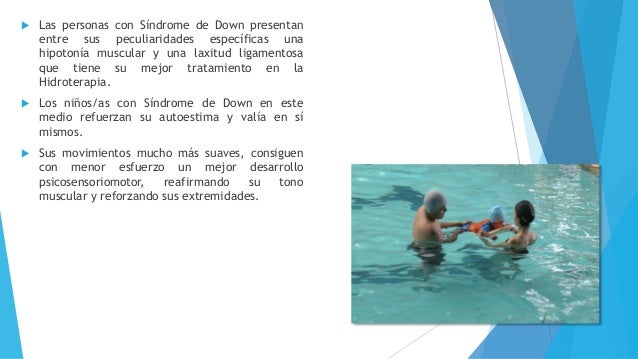 Sindrome De Down Articulos Cientificos Pdf