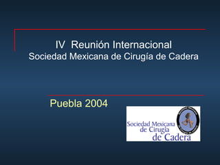 IV Reunión Internacional 
Sociedad Mexicana de Cirugía de Cadera 
Puebla 2004 
 