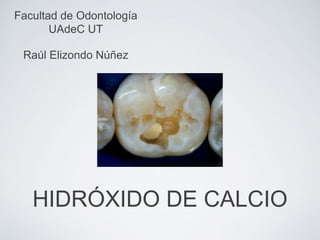 HIDRÓXIDO DE CALCIO
Raúl Elizondo Núñez
Facultad de Odontología
UAdeC UT
 