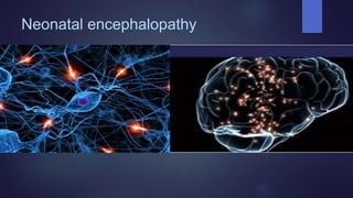 Neonatal encephalopathy
 