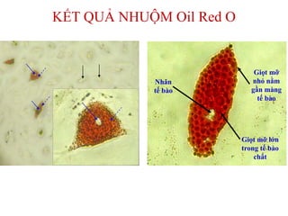 KẾT QUẢ NHUỘM Oil Red O
Nhân
tế bào
Giọt mỡ lớn
trong tế bào
chất
Giọt mỡ
nhỏ nằm
gần màng
tế bào
 