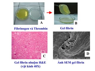 C
Gel fibrin nhuộm H&E
(vật kính 40X)
Fibrinogen và Thrombin
A B
Gel fibrin
Ảnh SEM gel fibrin
D
 
