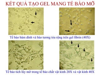 Tế bào bám dính và bào tương tỏa rộng trên gel fibrin (40X)
KẾT QUẢ TẠO GEL MANG TẾ BÀO MỠ
Tế bào tích lũy mỡ trong tế bào chất vật kính 20X và vật kính 40X
 
