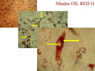 Nhuộm OIL RED O
 