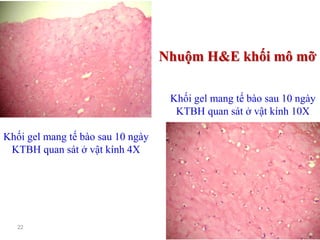 22
Khối gel mang tế bào sau 10 ngày
KTBH quan sát ở vật kính 4X
Nhuộm H&E khối mô mỡ
Khối gel mang tế bào sau 10 ngày
KTBH quan sát ở vật kính 10X
 