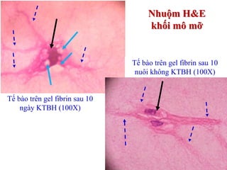 Tế bào trên gel fibrin sau 10
ngày KTBH (100X)
Nhuộm H&E
khối mô mỡ
Tế bào trên gel fibrin sau 10
nuôi không KTBH (100X)
 