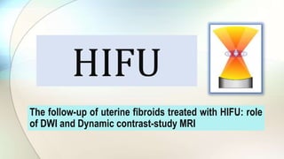 HIFU
The follow-up of uterine fibroids treated with HIFU: role
of DWI and Dynamic contrast-study MRI
 