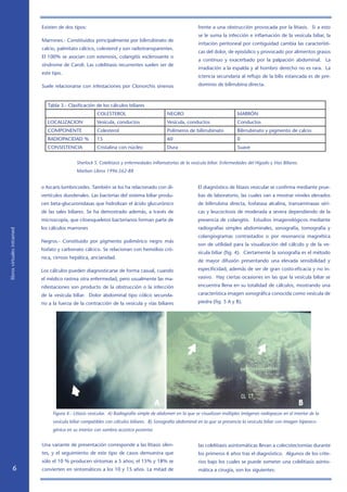 Existen de dos tipos:                                                            frente a una obstrucción provocada por la litiasis. Si a esto
                                                                                                             se le suma la infección e inflamación de la vesícula biliar, la
                            Marrones.- Constituidos principalmente por bilirrubinato de
                                                                                                             irritación peritoneal por contiguidad cambia las característi-
                            calcio, palmitato cálcico, colesterol y son radiotransparentes.
                                                                                                             cas del dolor, de episódico y provocado por alimentos grasos
                            El 100% se asocian con estenosis, colangitis esclerosante o
                                                                                                             a continuo y exacerbado por la palpación abdominal. La
                            síndrome de Caroli. Las colelitiasis recurrentes suelen ser de
                                                                                                             irradiación a la espalda y al hombro derecho no es rara. La
                            este tipo.
                                                                                                             ictericia secundaria al reflujo de la bilis estancada es de pre-

                            Suele relacionarse con infestaciones por Clonorchis sinensis                     dominio de bilirrubina directa.



                               Tabla 3.- Clasificación de los cálculos biliares
                                                       COLESTEROL                           NEGRO                                MARRÓN
                               LOCALIZACION            Vesícula, conductos                  Vesícula, conductos                  Conductos
                               COMPONENTE              Colesterol                           Polímeros de bilirrubinato           Bilirrubinato y pigmento de calcio
                               RADIOPACIDAD %          15                                   60                                   0
                               CONSISTENCIA            Cristalina con núcleo                Dura                                 Suave


                                             Sherlock S. Colelitiasis y enfermedades inflamatorias de la vesícula biliar. Enfermedades del Hígado y Vías Biliares.
                                             Marban Libros 1996:562-88


                            o Ascaris lumbricoides. También se los ha relacionado con di-                    El diagnóstico de litiasis vesicular se confirma mediante prue-
                            vertículos duodenales. Las bacterias del sistema biliar produ-                   bas de laboratorio, las cuales van a mostrar niveles elevados
                            cen beta-glucuronidasas que hidrolizan el ácido glucurónico                      de bilirrubina directa, fosfatasa alcalina, transaminasas séri-
                            de las sales biliares. Se ha demostrado además, a través de                      cas y leucocitosis de moderada a severa dependiendo de la
                            microscopía, que citoesqueletos bacterianos forman parte de                      presencia de colangitis. Estudios imagenológicos mediante
                            los cálculos marrones                                                            radiografías simples abdominales, sonografía, tomografía y
libros virtuales intramed




                                                                                                             colangiogramas contrastados o por resonancia magnética
                            Negros.- Constituido por pigmento polimérico negro más
                                                                                                             son de utilidad para la visualización del cálculo y de la ve-
                            fosfato y carbonato cálcico. Se relacionan con hemólisis cró-
                                                                                                             sícula biliar (fig. 4). Ciertamente la sonografía es el método
                            nica, cirrosis hepática, ancianidad.
                                                                                                             de mayor difusión presentando una elevada sensibilidad y

                            Los cálculos pueden diagnosticarse de forma casual, cuando                       especificidad, además de ser de gran costo-eficacia y no in-

                            el médico rastrea otra enfermedad, pero usualmente las ma-                       vasivo. Hay ciertas ocasiones en las que la vesícula biliar se

                            nifestaciones son producto de la obstrucción o la infección                      encuentra llena en su totalidad de cálculos, mostrando una

                            de la vesícula biliar. Dolor abdominal tipo cólico secunda-                      característica imagen sonográfica conocida como vesícula de

                            rio a la fuerza de la contracción de la vesícula y vías biliares                 piedra (fig. 5 A y B).




                                 Figura 4.- Litiasis vesicular. A) Radiografía simple de abdomen en la que se visualizan múltiples imágenes radiopacas en el interior de la
                                 vesícula biliar compatibles con cálculos biliares. B) Sonografía abdominal en la que se presencia la vesícula biliar con imagen hipereco-
                                 génica en su interior con sombra acústica posterior.


                            Una variante de presentación corresponde a las litiasis silen-                   las colelitiasis asintomáticas llevan a colecistectomías durante
                            tes, y el seguimiento de este tipo de casos demuestra que                        los primeros 6 años tras el diagnóstico. Algunos de los crite-
                            sólo el 10 % producen síntomas a 5 años; el 15% y 18% se                         rios bajo los cuales se puede someter una colelitiasis asinto-
                           convierten en sintomáticos a los 10 y 15 años. La mitad de                       mática a cirugía, son los siguientes:
 