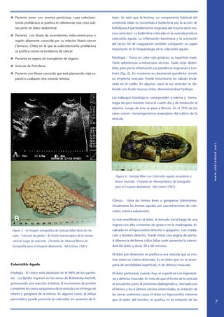 ✤ Paciente joven con anemia perniciosa, cuya colecistec-             tiasis. Se sabe que la lecitina, un componente habitual del
   tomía profiláctica se justifica en diferenciar una crisis sub-    contenido biliar es convertida a lisolecitina por la acción de
   secuente de dolor abdominal                                       fosfolipasa A (probablemente originada del trauma de la mu-
                                                                     cosa vesicular). La lisolecitina colocada en la vesícula produce
✤ Paciente con litiasis de ascendientes indio-americanos o
                                                                     colecistitis aguda. La inflamación bacteriana y la activación
   región altamente conocida por su relación litiasis-cáncer
                                                                     del factor XII de coagulación también comparten un papel
   (Temuco, Chile) en la que la colecistectomía profiláctica
                                                                     importante en la fisiopatología de la colecistitis aguda.
   se justifica contra la incidencia de cáncer.

✤ Paciente en espera de transplante de órgano.                       Patología.- Toma un color rojo-grisáceo, su superficie mate.
                                                                     Tiene adherencias a estructuras vecinas. Suele estar disten-
✤ Vesícula de Porcelana
                                                                     dida, pero por la inflamación sus paredes se engruesan y con-
✤ Paciente con litiasis conocida que esté planeando viaje es-        traen (fig. 6). En ocasiones es claramente purulenta, siendo
   pacial o cualquier otra travesía remota.                          un empiema vesicular. Puede encontrarse un cálculo encla-
                                                                     vado en el cuello. En algunos casos la luz vesicular se dis-
                                                                     tiende con fluido mucoso claro, denominándose hydrops.

                                                                     Los hallazgos histológicos corresponden a edema y hemo-
                                                                     rragia de pico máximo hacia el cuarto día y de resolución al
                                                                     séptimo. Luego de esto se pasa a fibrosis. En el 75% de los
                                                                     casos crecen microorganismos anaerobios del cultivo de la
                                                                     vesícula.




                                                                       Figura 6.- Vesícula Biliar con Colecistitis aguda secundaria a
                                                                       litiasis vesicular. (Tomado de: Manual Básico de Sonografía
                                                                       para el Cirujano Abdominal. NA Gómez 1987)



                                                                     Clínica.-   Varía de formas leves a gangrenas fulminantes.
                                                                     Usualmente las formas agudas son exacerbaciones de cole-
                                                                     cistitis crónica subyacente.

                                                                     Lo más manifiesto es el dolor. A menudo inicia luego de una
                                                                     ingesta con alto contenido de grasa o en la madrugada, lo-
 Figura 5.- A) Imagen sonográfica de vesícula biliar llena de cál-   calizado en el hipocondrio derecho o epigastrio con irradia-
 culos -“vesícula de piedra”. B) Visión macroscópica de la misma     ción a hombro derecho. Puede imitar una angina de pecho.
 vesícula luego de resecarla. (Tomado de: Manual Básico de           A diferencia del breve cólico biliar suele aumentar la intensi-
 Sonografía para el Cirujano Abdominal. NA Gómez 1987)               dad del dolor y durar 30 a 60 minutos.

                                                                     El dolor por distensión se justifica a una vesícula que se con-
                                                                     trae sobre un cístico obstruido. Es un dolor que no se acom-
Colecistitis Aguda                                                   paña de sensibilidad superficial, ni de defensa muscular.

Etiología.- El cístico está obstruido en el 96% de los pacien-       El dolor peritoneal, cuando hay, es superficial con hipereste-
tes. Los lípidos ingresan en los senos de Rokitansky-Aschoff,        sia y defensa muscular. En vista de que el fondo de la vesícula
provocando una reacción irritativa. El incremento de presión         se encuentra junto al peritoneo diafragmático, inervado por
comprime los vasos sanguíneos de la vesícula con el riesgo de        el frénico y los 6 últimos nervios intercostales, la irritación de
infarto y gangrena de la misma. En algunos casos, el reflujo         las ramas anteriores causa el dolor en hipocondrio mientras
pancreático puede provocar la colecistitis en ausencia de li-        que el dolor del hombro se justifica en la irritación de las
                                                                                                                                          
 