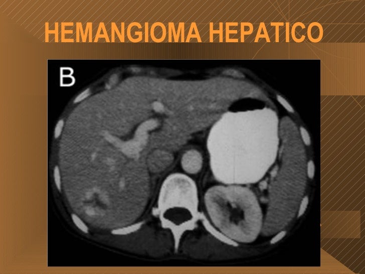 Radiologia Higado Dra Marroquin