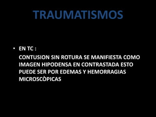 TRAUMATISMOS
• EN TC :
CONTUSION SIN ROTURA SE MANIFIESTA COMO
IMAGEN HIPODENSA EN CONTRASTADA ESTO
PUEDE SER POR EDEMAS Y HEMORRAGIAS
MICROSCÒPICAS
 
