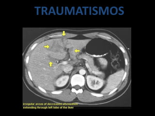 TRAUMATISMOS
 