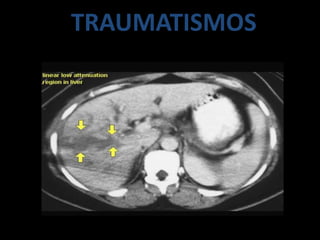 TRAUMATISMOS
 