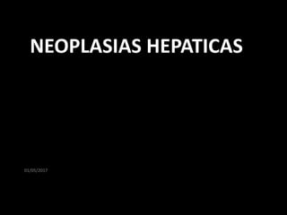01/05/2017
NEOPLASIAS HEPATICAS
 