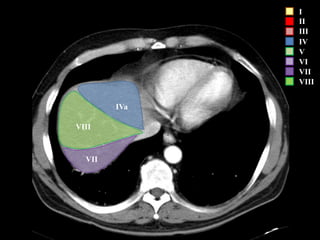 I
II
III
IV
V
VI
VII
VIII
IVa
VIII
VII
 