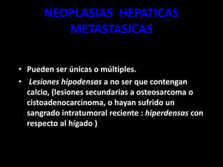 NEOPLASIAS HEPATICAS
METASTASICAS
• Pueden ser únicas o múltiples.
• Lesiones hipodensas a no ser que contengan
calcio, (lesiones secundarias a osteosarcoma o
cistoadenocarcinoma, o hayan sufrido un
sangrado intratumoral reciente : hiperdensas con
respecto al hígado )
 