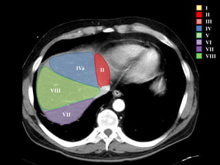 I
II
III
IV
V
VI
VII
VIII
VII
VIII
IVa II
 