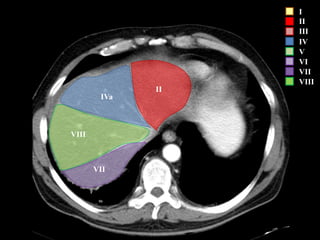 I
II
III
IV
V
VI
VII
VIII
VII
VIII
IVa
II
 