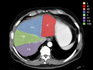 I
II
III
IV
V
VI
VII
VIII
VII
VIII
IVa
II
 