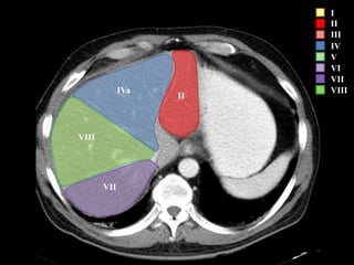 I
II
III
IV
V
VI
VII
VIII
VII
VIII
IVa
II
 