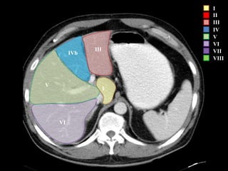 I
II
III
IV
V
VI
VII
VIII
VI
V
I
IVb
III
 