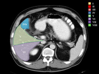 I
II
III
IV
V
VI
VII
VIII
VI
V
IVb
 
