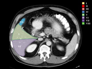 I
II
III
IV
V
VI
VII
VIII
VI
V
IVb
 