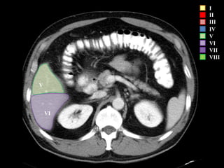 I
II
III
IV
V
VI
VII
VIII
VI
V
 