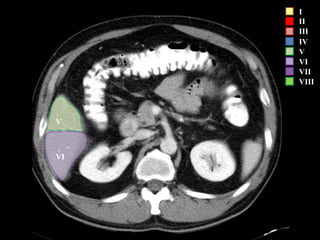 I
II
III
IV
V
VI
VII
VIII
VI
V
 