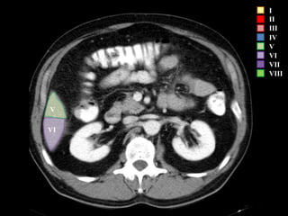 I
II
III
IV
V
VI
VII
VIII
VI
V
 