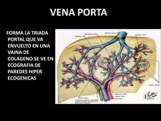 VENA PORTA
FORMA LA TRIADA
PORTAL QUE VA
ENVUELTO EN UNA
VAINA DE
COLAGENO SE VE EN
ECOGRAFIA DE
PAREDES HIPER
ECOGENICAS
 