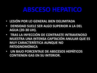 ABSCESO HEPATICO
• LESIÓN POR LO GENERAL BIEN DELIMITADA
• DENSIDAD SUELE SER ALGO SUPERIOR A LA DEL
AGUA (20-30 UH).
• TRAS LA INYECCIÓN DE CONTRASTE INTRAVENOSO
MUESTRA UNA INTENSA CAPTACIÓN ANULAR QUE ES
MUY CARACTERÍSTICA AUNQUE NO
PATOGNOMÓNICA
• UN BAJO PORCENTAJE DE ABSCESOS HEPÁTICOS
CONTIENEN GAS EN SU INTERIOR.
 