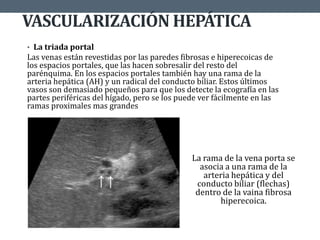 VASCULARIZACIÓN HEPÁTICA
• La triada portal
Las venas están revestidas por las paredes fibrosas e hiperecoicas de
los espacios portales, que las hacen sobresalir del resto del
parénquima. En los espacios portales también hay una rama de la
arteria hepática (AH) y un radical del conducto biliar. Estos últimos
vasos son demasiado pequeños para que los detecte la ecografía en las
partes periféricas del hígado, pero se los puede ver fácilmente en las
ramas proximales mas grandes
La rama de la vena porta se
asocia a una rama de la
arteria hepática y del
conducto biliar (flechas)
dentro de la vaina fibrosa
hiperecoica.
 