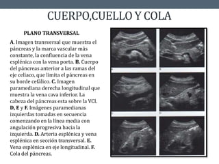 CUERPO,CUELLO Y COLA
A. Imagen transversal que muestra el
páncreas y la marca vascular más
constante, la confluencia de la vena
esplénica con la vena porta. B. Cuerpo
del páncreas anterior a las ramas del
eje celiaco, que limita el páncreas en
su borde cefálico. C. Imagen
paramediana derecha longitudinal que
muestra la vena cava inferior. La
cabeza del páncreas esta sobre la VCI.
D, E y F. Imágenes paramedianas
izquierdas tomadas en secuencia
comenzando en la línea media con
angulación progresiva hacia la
izquierda. D. Arteria esplénica y vena
esplénica en sección transversal. E.
Vena esplénica en eje longitudinal. F.
Cola del páncreas.
PLANO TRANSVERSAL
 
