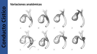Variaciones anatómicasConductoCístico
 