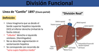 División Funcional
Línea de “Cantlie” 1897 (Cisura portal)
• Línea imaginaria que va desde el
borde superior hepático izquierdo
(VCI) al inferior derecho (mitad de la
fosita cística).
• “Lóbulos” derecho e izquierdo
similares. (Hemihigados)
• No se describe segmentación ni
sectorización hepática
• Se corresponde con recorrido de
“vena supra hepática media”
“División Real”
Definición
 