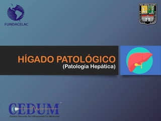 HÍGADO PATOLÓGICO
(Patología Hepática)
 