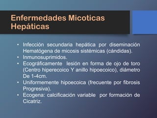 Enfermedades Micoticas
Hepáticas
• Infección secundaria hepática por diseminación
Hematógena de micosis sistémicas (cándidas).
• Inmunosuprimidos.
• Ecográficamente lesión en forma de ojo de toro
(Centro hiperecoico Y anillo hipoecoico), diámetro
De 1-4cm.
• Uniformemente hipoecoica (frecuente por fibrosis
Progresiva).
• Ecogena: calcificación variable por formación de
Cicatriz.
 