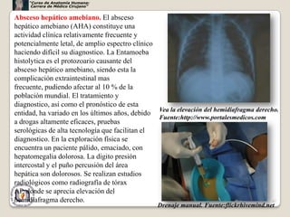 “Curso de Anatomía Humana:
      Carrera de Médico Cirujano”


Absceso hepático amebiano. El absceso
hepático amebiano (AHA) constituye una
actividad clínica relativamente frecuente y
potencialmente letal, de amplio espectro clínico
haciendo difícil su diagnostico. La Entamoeba
histolytica es el protozoario causante del
absceso hepático amebiano, siendo esta la
complicación extraintestinal mas
frecuente, pudiendo afectar al 10 % de la
población mundial. El tratamiento y
diagnostico, así como el pronóstico de esta
entidad, ha variado en los últimos años, debido Vea la elevación del hemidiafragma derecho.
                                                 Fuente:http://www.portalesmedicos.com
a drogas altamente eficaces, pruebas
serológicas de alta tecnología que facilitan el
diagnostico. En la exploración física se
encuentra un paciente pálido, emaciado, con
hepatomegalia dolorosa. La digito presión
intercostal y el puño percusión del área
hepática son dolorosos. Se realizan estudios
radiológicos como radiografía de tórax
AP, donde se aprecia elevación del
hemidiafragma derecho.                                                                   47
                                                 Drenaje manual. Fuente:flickrhivemind.net
 