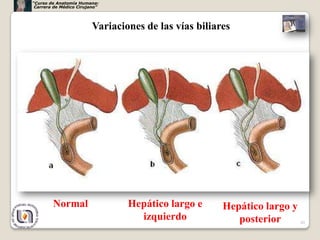 “Curso de Anatomía Humana:
 Carrera de Médico Cirujano”




                         Variaciones de las vías biliares




        Normal                   Hepático largo e      Hepático largo y
                                   izquierdo              posterior     49
 