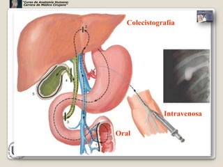 “Curso de Anatomía Humana:
 Carrera de Médico Cirujano”




                                  Colecistografía




                                             Intravenosa

                               Oral

                                                           54
 