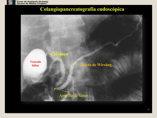 “Curso de Anatomía Humana:
 Carrera de Médico Cirujano”


                    Colangiopancreatografia endoscópica




                               Colédoco
            Vesícula
             biliar                            Ducto de Wirsüng




                                  Ampolla de Vatter


                                                                  56
 
