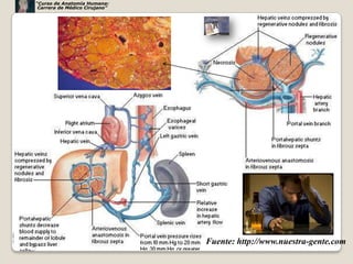 “Curso de Anatomía Humana:
 Carrera de Médico Cirujano”




                               Fuente: http://www.nuestra-gente.com
                                                                71
 