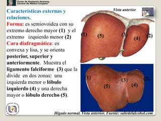 “Curso de Anatomía Humana:
     Carrera de Médico Cirujano”



Características externas y                                              Vista anterior

relaciones.
Forma: es semiovoidea con su
extremo derecho mayor (1) y el
extremo izquierdo menor (2)     (1)                         (5)              (3)           (2)
                                                                                    (4)
Cara diafragmática: es
convexa y lisa, y se orienta
posterior, superior y
anteriormente. Muestra el
ligamento falciforme (3) que la
divide en dos zonas: una          (1)                                        (3)          (2)
izquierda menor o lóbulo
                                                                  (5)              (4)
izquierdo (4) y una derecha
mayor o lóbulo derecho (5).


                                   Hígado normal. Vista anterior. Fuente: salirdelalcohol.com8
 