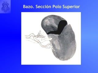 Bazo. Sección Polo Superior 