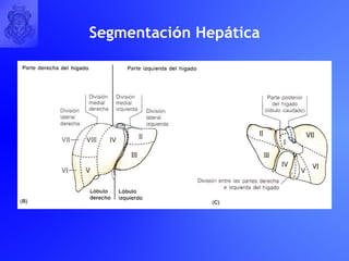Segmentaci ó n Hep á tica 